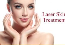 Acne Scar Laser Treatment in Lahore