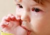 Redness on Eyelid of Infant