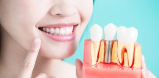 7 Facts You Can't Afford To Miss About Dental Implants