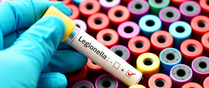 Legionella Testing Market