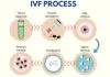 IVF procedure