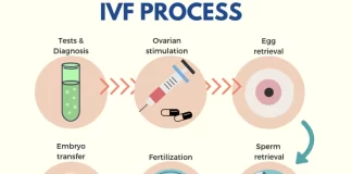 IVF procedure