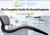 The Complete Guide On Dental Implants