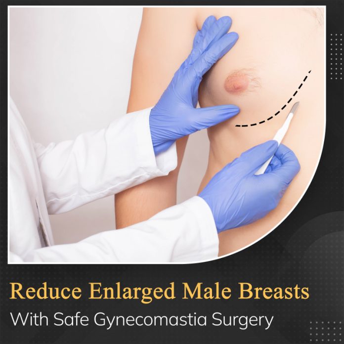 Why Should You Go for Male Breast Reduction Surgery Reasons to Know