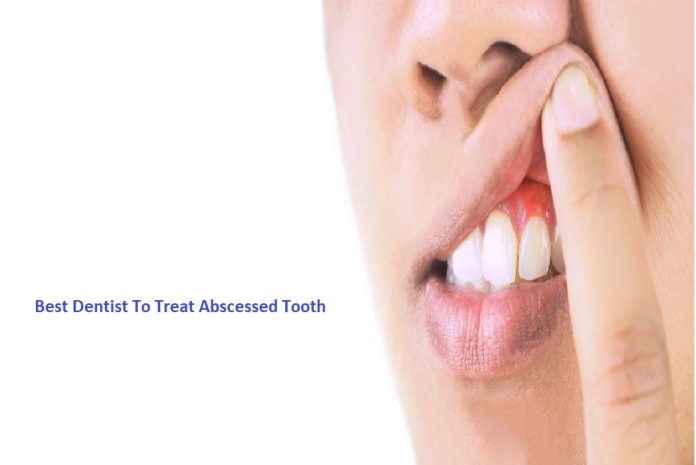 Best Dentist To Treat Abscessed Tooth