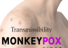 Monkeypox Virus: Pattern of human-to-human transmissibility